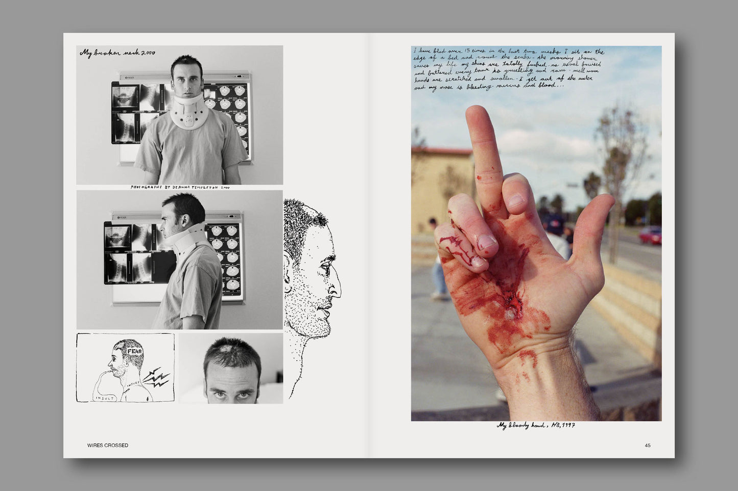 Signed - Issue 212: Meet The Templetons
